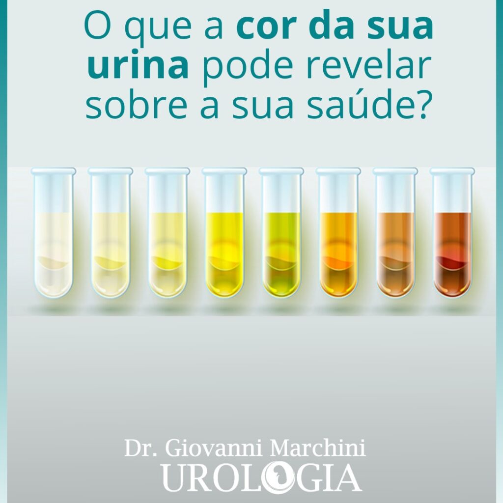 Entenda O Que A Cor De Sua Urina E A Creatinina No Sangue Dizem Sobre A Saúde De Seus Rins O 8742