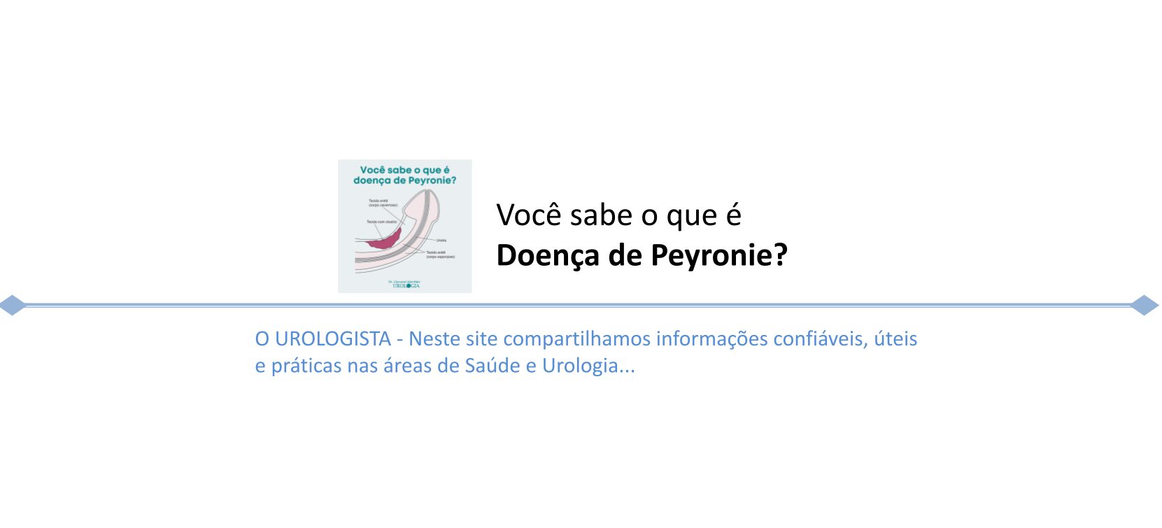 Você sabe o que é doença de Peyronie?